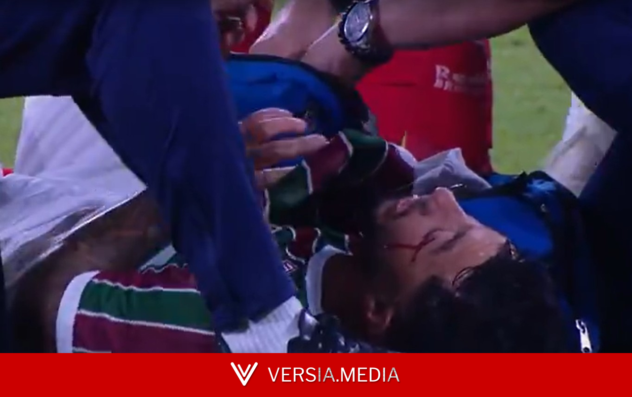 Fluminense x Bragantino: Lucho Acosta fica sangrando após cotovelada de Agustín Sant'Anna